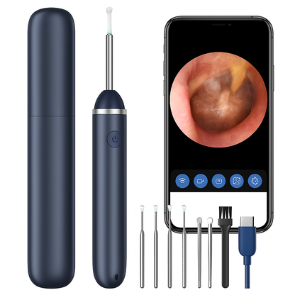 Nettoyant d’oreille avec caméra HD — Kit NK3 Pro